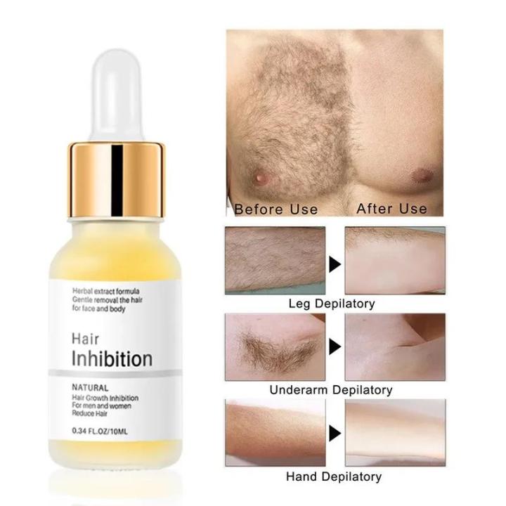 HeYang%20Permanent%20Hair%20inhibition%20Serum%20Painless%20Hair%20Remover%20Armpit%20Legs%20Arms%20Hair%20Growth%20Inhibitor%20Beauty%20Skin%20Care%20Body%20Essential%20Oil%20phone%20case%20-%20Image%202