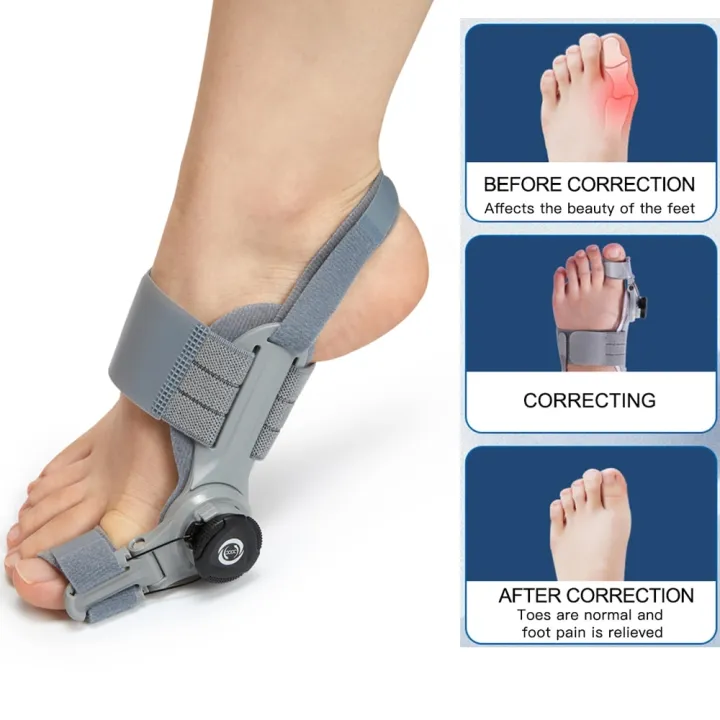 Bunion%20Splint%20Big%20Toe%20Straightener%20Hallux%20Valgus%20Corrector%20Orthotics%20Foot%20Bone%20Thumb%20Adjuster%20Correction%20Pedicure%20Brace%20-%20Image%202