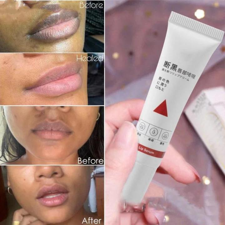Naturally Pink Serum Lips Pink Fresh Remove Dark Lips Gel Lightening Essence Cream Balm Repair Fine Line Brighten Lip Exfoliator