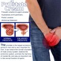 Prostate Cream Prostate Cream Safe Highly Effective Reliable Discomfort Relief Prostate Care Cream for Men.