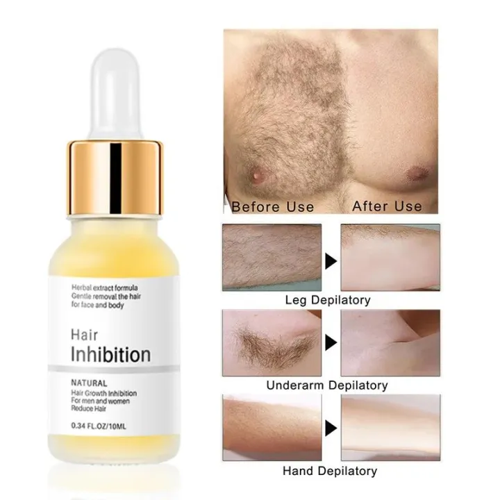 Permanent%20Hair%20inhibition%20Serum%20Painless%20Hair%20Remover%20Armpit%20Legs%20Arms%20Hair%20Growth%20Inhibitor%20Beauty%20Skin%20Care%20Body%20Essential%20Oil%20-%20Image%202