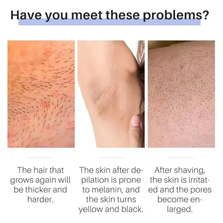 Permanent%20Hair%20Removal%20Cream%20Facial%20Hair%20Remover%20Depilatory%20Painless%20for%20Beard%20Armpit%20Body%20Persistent%20Inhibition%20of%20Hair%20Growth%20-%20Image%202