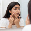 BioCare Premium Anti-Acne and Hormone Balance Gummies. 