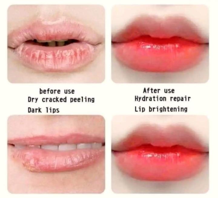 Vaseline%20Lip%20Therapy%20Rosy%20Lip%2020g%20Lip%20Balm%20in%202024%20-%20Image%202