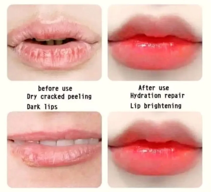 Vaseline%20Lip%20Therapy%20Rosy%20Lip%2020g%20Lip%20Balm%20in%202024%20-%20Image%202