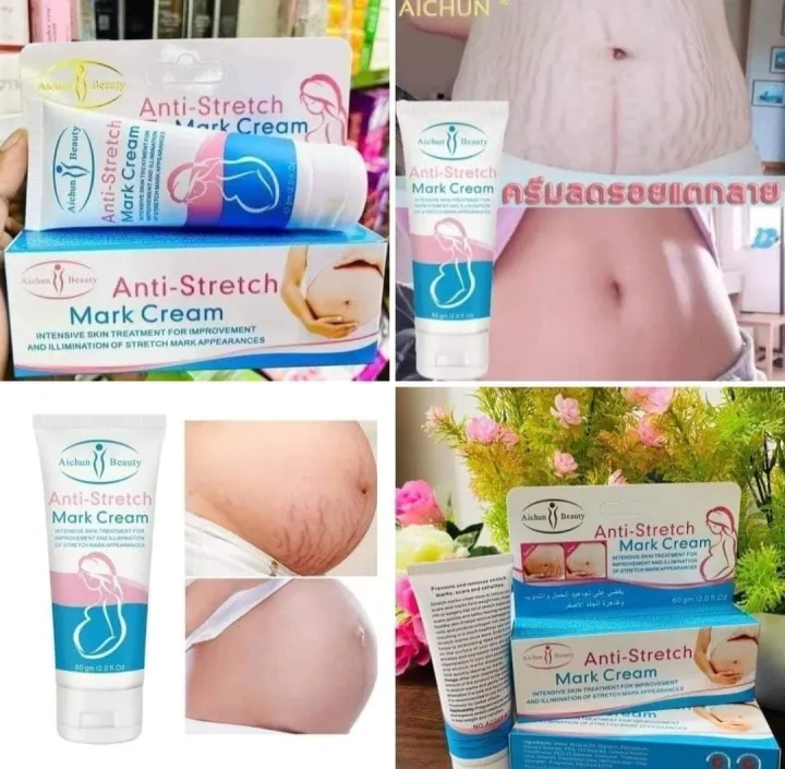 Stretch%20Marks%20Cream%2060%20G%20-%20Image%202