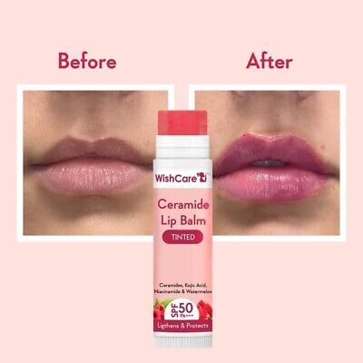 WishCare%20Tinted%20Ceramide%20Lip%20Balm%20with%20SPF50%20PA+++%20-%20Kojic%20Acid%20&%20Niacinamide%20-%20For%20Lip%20Lightening%20&%20Protection%205gm%20-%20Image%204