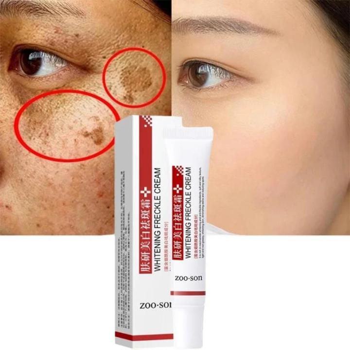 BAIZTON Whitening Anti Freckle Cream (Facial)