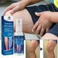 Varicose Veins Spray Medicine Spider Veins Relief Vasculitis Phlebitis Spider Pain Relief Plaster Care 30ml. 