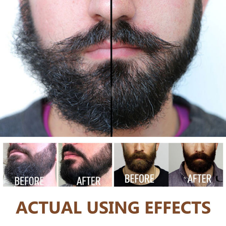 Beard%20Oil%20Enhance%20Mustache%20Nourishing%20Smooth%20Longer%20Thicker%20Regrowth%20Shine%20Strengthens%20Anti%20Hair%20Loss%20Treatment%20Beard%20Growth%20Oil%20-%20Image%206