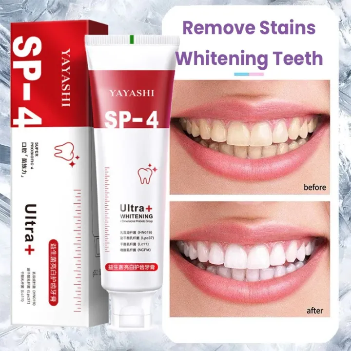 Sp 4 New SP-4 Probiotic Whitening Toothpaste | Daraz.com.bd