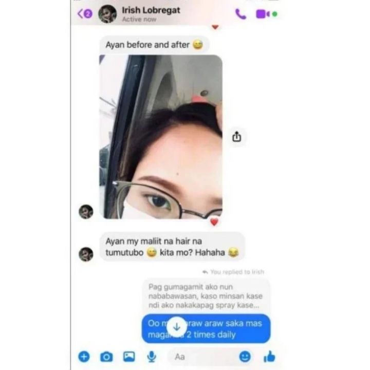 TRSTAY%20Hair%20Spray%20Hairloss%20Hair%20Tools%20Rosemary%20Oil%20for%20Hair%20Professional%20Brazilian%20Keratin%20New%20Hair%20Growth%20Essence%20Care%20Products%20-%20Image%203