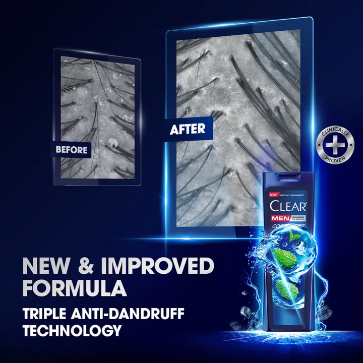 Clear%20Men%20Shampoo%20Cool%20Sport%20Menthol%20Anti%20Dandruff%20330ml%20-%20Image%204