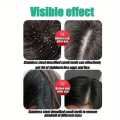 Ukun Chiruni Lice Hair Comb 1 Pc.
