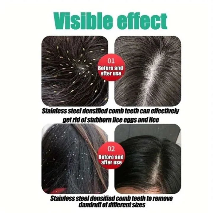 Ukun%20Chiruni%20Lice%20Hair%20Comb%201%20Pc%20-%20Image%209