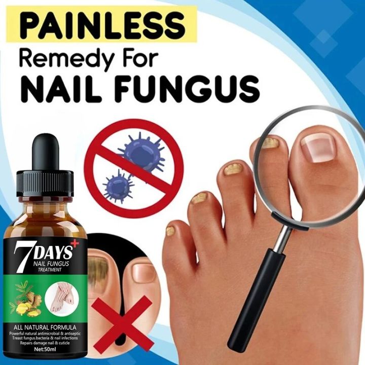 7DAYS%20Repair%20Nail%20Fungus%20Treatments%20Essence%20Foot%20Care%20Serum%20Toe%20Nails%20Fungal%20Removal%20Gel%20Anti-Infection%20Onychomycosis%20Care%20Tool%20-%20Image%206