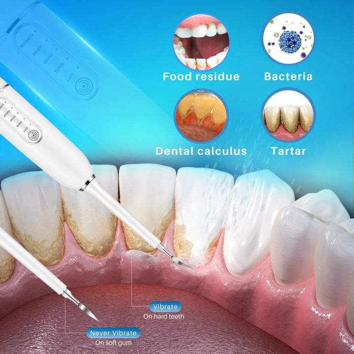 Ultrasonic%20Tooth%20Cleaner%20Electric%20Tooth%20Brush%20Tartar%20Eliminator%20Scraper%20Cleaner%20Dental%20Scaler%20Calculus%20Stone%20Plaque%20Remover%20-%20Image%204