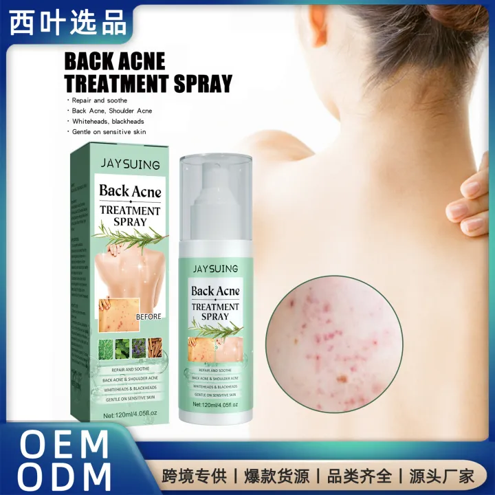 Back%20Acne%20Repair%20Spray%20Anti%20Pimples%20Marks%20Acne%20Spots%20Removal%20Oil%20Control%20Body%20Whitening%20Exfoliating%20Back%20Pimple%20Treatment%20Spray%20-%20Image%206