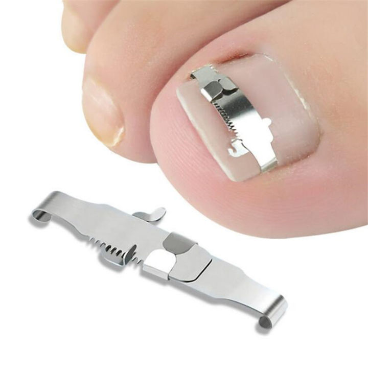 Ingrown toenail corrector Tools Pedicure Recover Embed Toe Nail Treatment professional Ingrown toenail correction Foot Care Tool