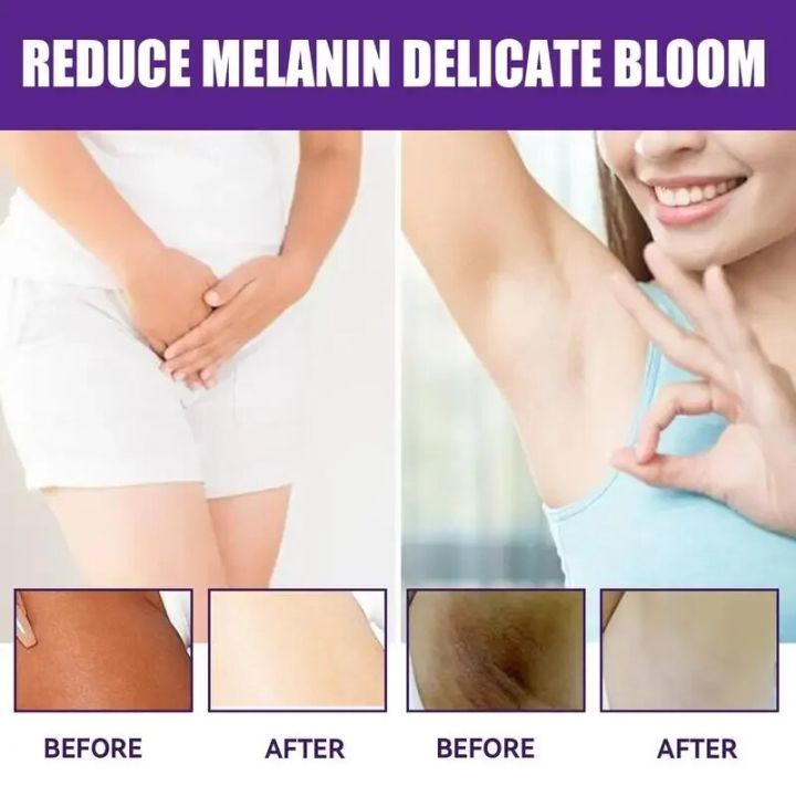Lightening%20Cream%20Dark%20Neck%20Lightening%20Cream%20Brightens%20And%20Moisturizes%20For%20Intimate%20Areas%20Armpit%20Neck%20Back%20Legs%20Elbows%20-%20Image%204