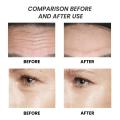 Snail Mucin Repairing Essence Anti-aging Fade Fine Line 100ml Lift Firm Face Serum Anti Wrinkles Lifting Whiten Brighten Toner. 