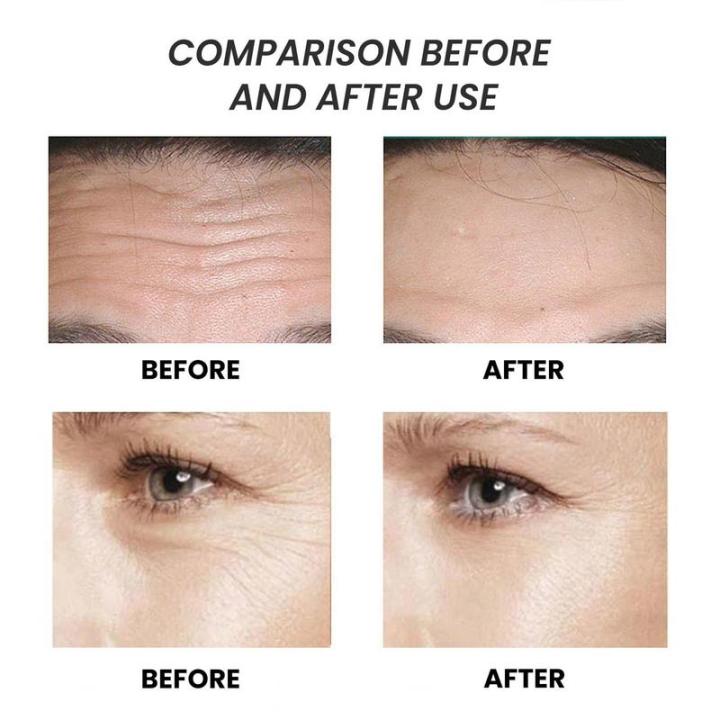 Snail%20Mucin%20Repairing%20Essence%20Anti-aging%20Fade%20Fine%20Line%20100ml%20Lift%20Firm%20Face%20Serum%20Anti%20Wrinkles%20Lifting%20Whiten%20Brighten%20Toner%20-%20Image%204