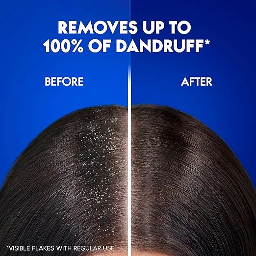 Head%20&%20Shoulders%20Classic%20Clean%20Anti-Dandruff%20Shampoo%20for%20Normal%20Hair,%20400%20ml%20Dhubai%20-%20Image%205