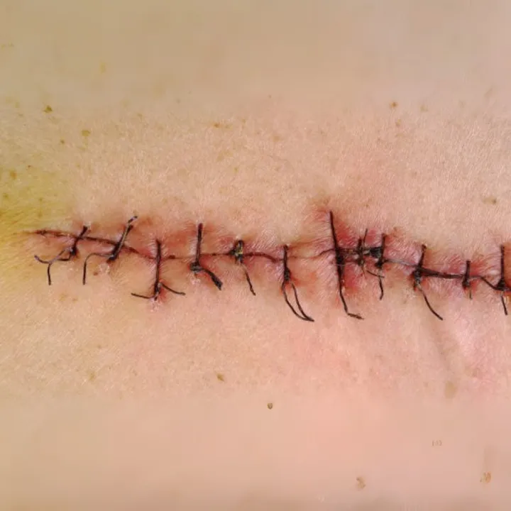 Absorbable%20Suture%20Brown%20chromic%20Catgut%20%E2%80%93%20Medgut%201-0%20(4%20Metric),%2076cm%20%7C%203/8%20Circle%20Round%20body%20Needle%20%E2%80%93%2040mm%201%20Pcs%20-%20Image%208