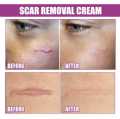 Scar Removal Cream Repairing Damaged Skin Reducing Scars And Smoothing The Skin 50g, কাটা ও পুড়ে যাওয়ার দাগ স্কিন থেকে মুছে ফেলুন। মুখমন্ডল, হাত, পা, বডি অথবা স্কিনের যেকোনো যায়গাতে ব্যবহার করতে পারবেন, #lazbinstore. 
