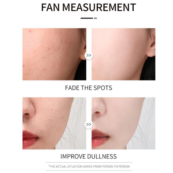 Face%20Serum%20Black%20Spot%20Remover,%20Pibamy%20Black%20Spot%20Remover%20Chino,%20Vitamin%20C%20Face%20Serum%20For%20Freckles,%20Dark%20Spot%20Remover%20For%20Wo%20E5D1%20-%20Image%206