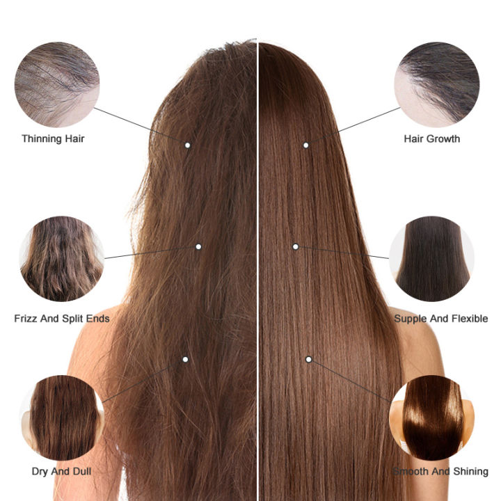 RtopR%20Moroccan%20Hair%20Loss%20Prevention%20and%20Growth%20Almond%20Oil%20Promotes%20Hair%20Growth%20Repairs%20Hair%20Roots%20Restores%20Strength%20and%20Shine%20Portable%20Hair%20Care%20Oil%20Conditioner%2035ml%20-%20Image%204