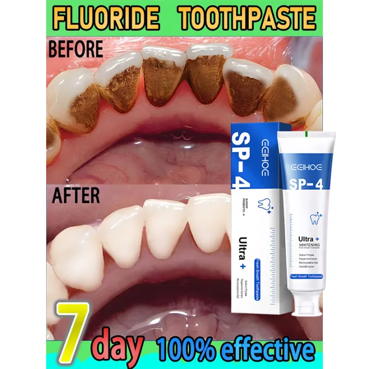120g%20Probiotic%20Toothpaste%20SP-4%20Whitening%20Tooth%20Remove%20Bad%20Breath%20Plaque%20Stains%20Teeth%20Whitener%20Oral%20Hygiene%20Care%20Clean%20Fresh%20Breath%20-%20Image%202