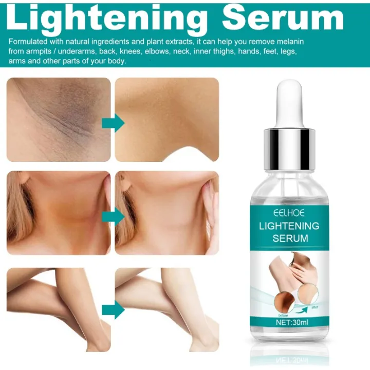 Underarm%20Beauty%20Essence%20Dark%20Spot%20Repair%20Whitening%20Cream%20Brighten%20Knee%20Body%20Pigmentation%20Melanin%20Removel%20Moisturize%20Glowing%20Skin%20-%20Image%204