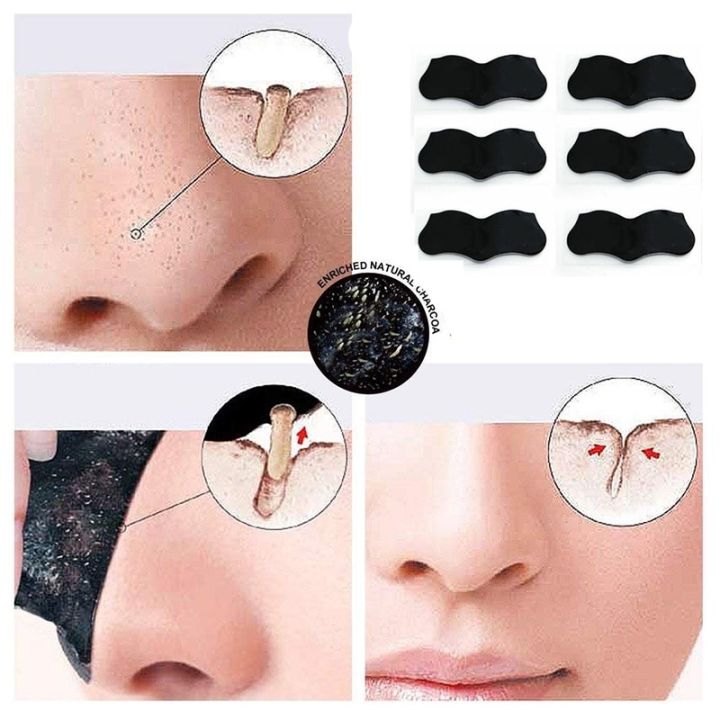 Blackhead%20Remover%20Nose%20Sticker%20Acne%20Treatment%20Mask%20Nose%20Sticker%205-60pc%20From%20Black%20Dots%20Cleaner%20Nose%20Pore%20Deep%20Cleaning%20Skin%20Care%20-%20Image%203