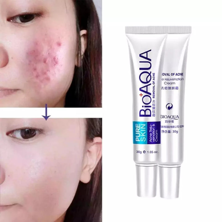 BIOAQUA%20Pure%20Skin%20Acne%20Rejuvenation%20&%20Cream%20-%2030g%20-%20Image%203