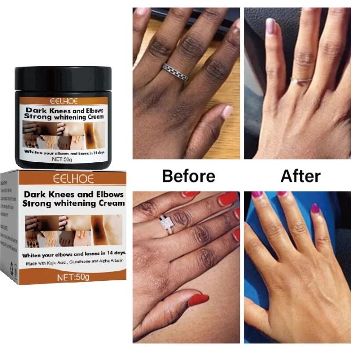 Dark s Fast Whitening Cream Pigmentation Correctors For Black Skin Hand Elbows Knee Intense Stains Remover Cream