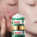 SADOER Facial Cream Acne Care Moisturizing Tea Tree Oil Acne Pimple Scar Removal Anti Acne for Face Skin Care - 50g. 