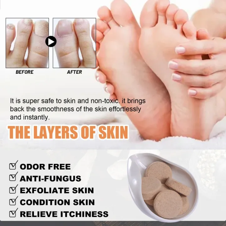 EELHOE%20Foot%20Bath%20Foot%20Soak%20Tablets,%20Old%20Ginger%20Foot%20Soak%20Tablets,%20Cold%20Repellent,%20Nail%20Fungus%20Repair%20Foot%20Repair%20Foot%20Treatment%20-%20Image%205