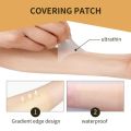 Instantly Tattoo Scar Cover Up Body Flaw Concealer Patches Skin Invisible Blemish Covering Sticker Waterproof Scar Treatment.