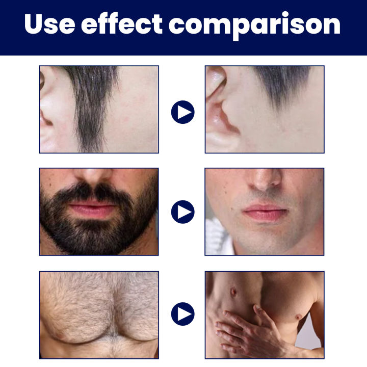 Hair%20Removal%20Cream%20Painless%20Beard%20Underarm%20Private%20Facial%20Body%20Leg%20Hair%20Remove%20Smooth%20Skin%20Hydrating%20Men%20Hair%20Growth%20Inhibitor%20-%20Image%206