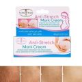 Aichun Beauty Anti-Stretch Marks Cream | Stretch Marks Removal Cream 60g. 