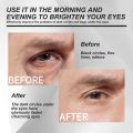 Eye Bag Removal Cream Men Anti Age Wrinkle Dark Circles Under The Eyes Remover Lifting Firm Skin Brightening Moisturizer Cream Abandon Abandon. 