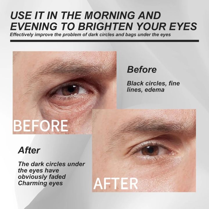 Eye%20Bag%20Removal%20Cream%20Men%20Anti%20Age%20Wrinkle%20Dark%20Circles%20Under%20The%20Eyes%20Remover%20Lifting%20Firm%20Skin%20Brightening%20Moisturizer%20Cream%20Abandon%20Abandon%20-%20Image%203