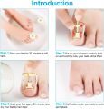 Medical Ingrown Toenail Correction Brace Kit Professional Toe Nail Care Pedicure Manicure Clipper Fixer Recover Corrector Tool.