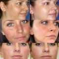 【The Edge of Beauty】Whitening freckle cream remove melasma melanin spots lightening cream. 