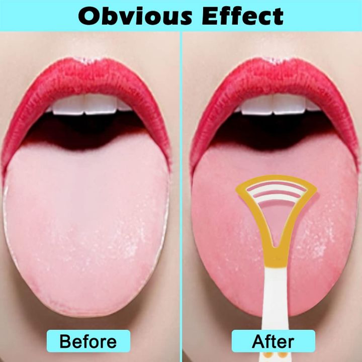 Tongue%20Scraper%20Plastic%20for%20Oral%20care%20Kids%20and%20Adults%201pcs%20-%20Image%207