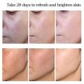 Dark Spot Corrector Cream Skin Whitening Fade Lightening Blemish Serum Reduces Age Spots Freckles Removal Face Day Cream 20g.