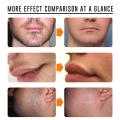 Skin Natural Warm Painless Hair Removal Cream 60ml for Men for FACIAL Arms Leg Body Inhibitor creates smooth and M9K3. 