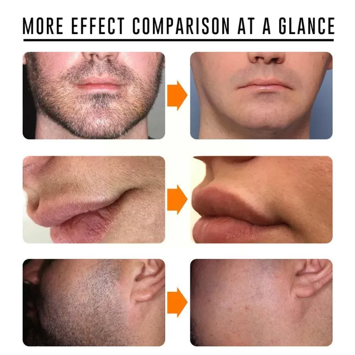 Skin%20Natural%20Warm%20Painless%20Hair%20Removal%20Cream%2060ml%20for%20Men%20for%20FACIAL%20Arms%20Leg%20Body%20Inhibitor%20creates%20smooth%20and%20M9K3%20-%20Image%205