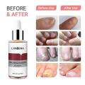 LANBENA Nail Repair Essence Serum Fungal Nail Treatment 15ml.